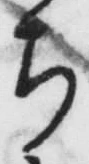 “ち”字