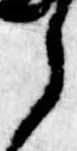미지정 위치 확인됨