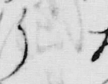 “つ”字