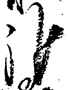 雑の位置