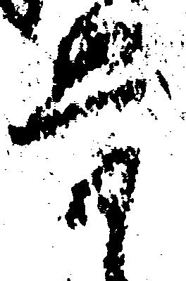 骨 위치 확인됨